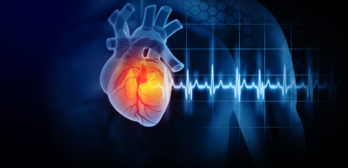 Heart attack and heart disease. 3d illustration