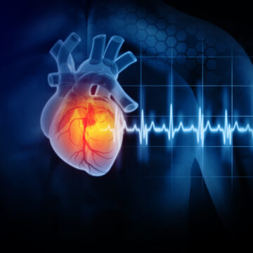 Heart attack and heart disease. 3d illustration